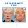 דרמטוקס™ – סרום בוטוקס טבעי למראה צעיר ומתוח