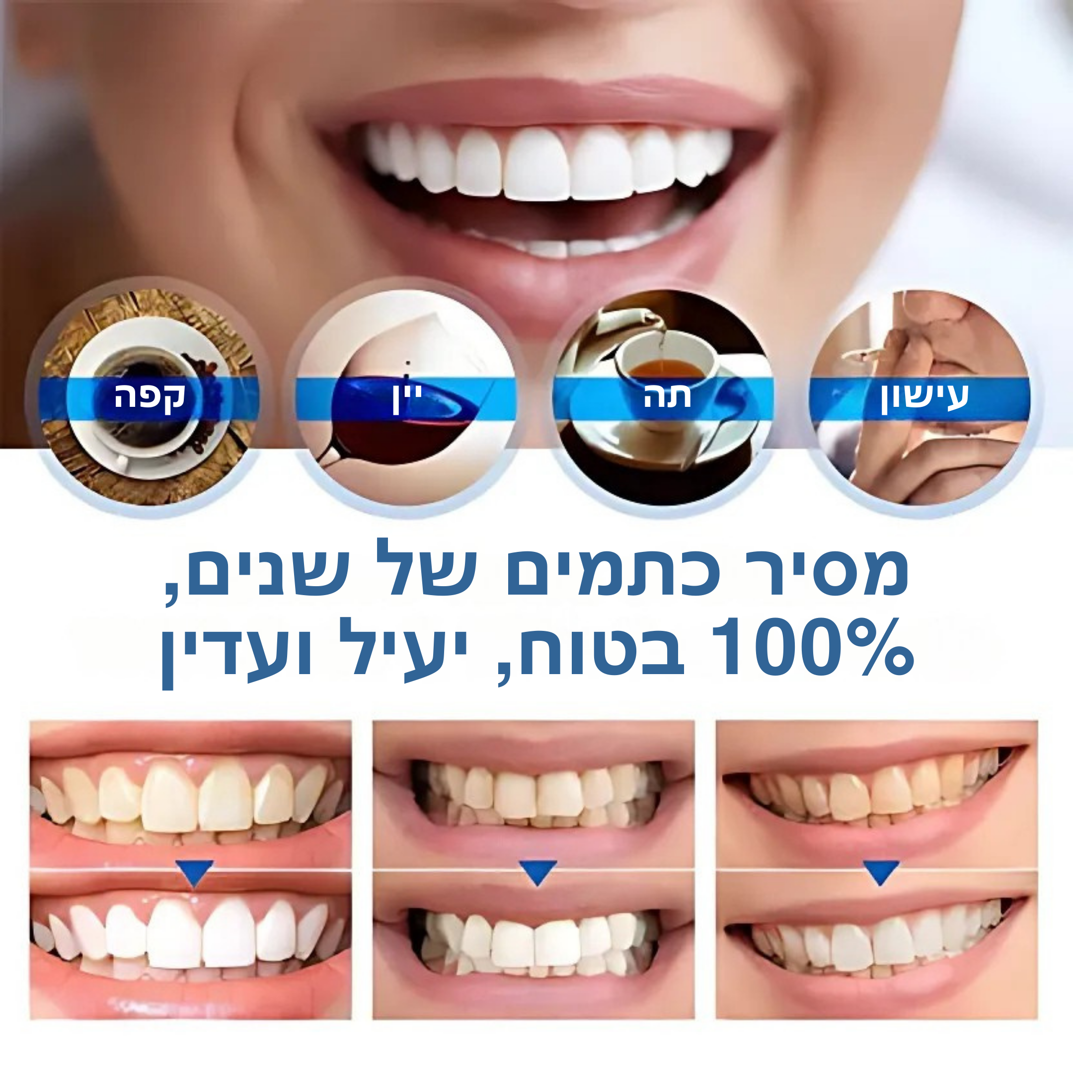 בריליאנטסמייל™ – עט הלבנה להסרת כתמים וחיזוק היגיינת הפה