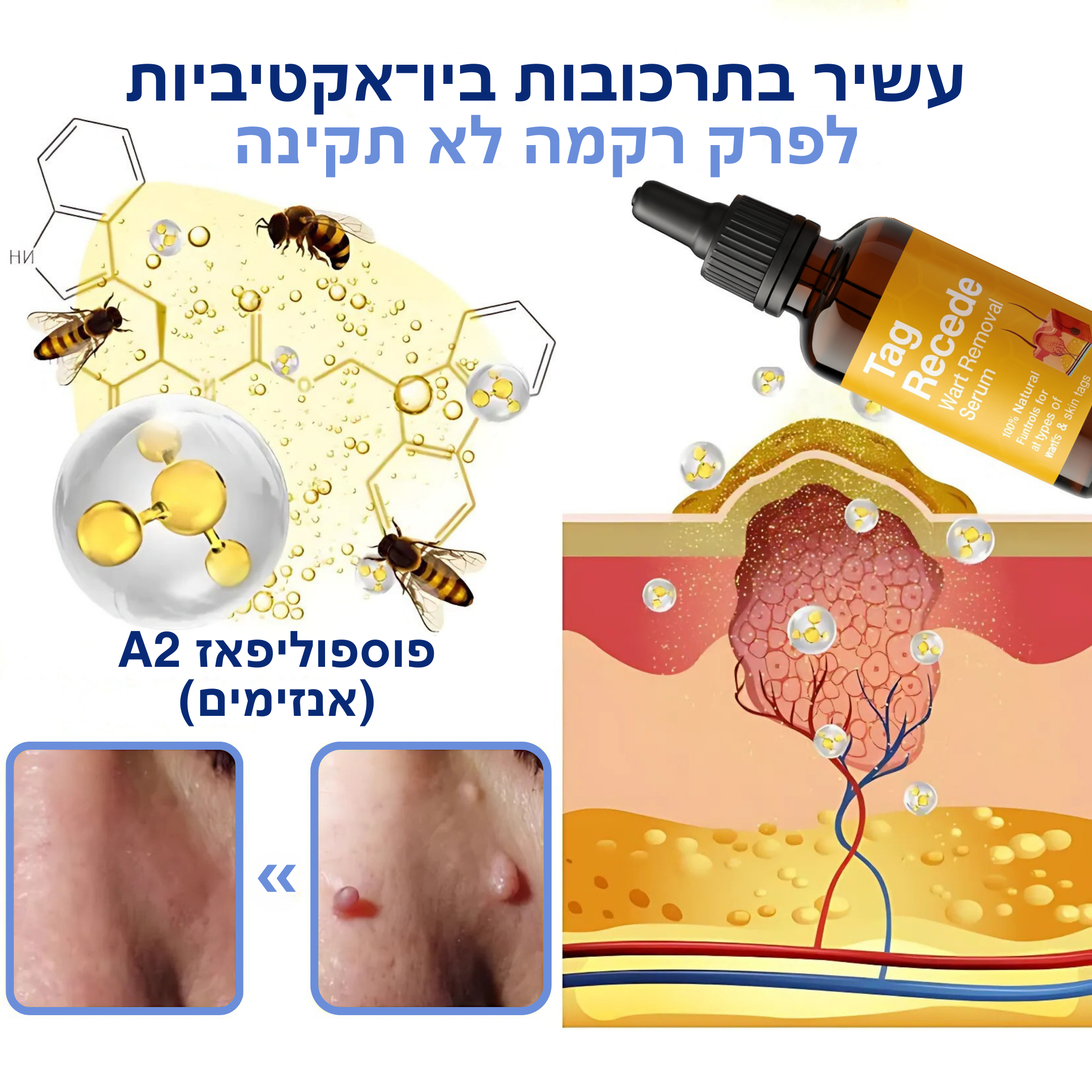 ביאוקליר™ – פתרון ביולוגי בארס דבורים להסרת תגי עור ויבלות