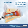 ויזיואיר™ – מצלמת אוזן חכמה לניקוי בטוח וברור