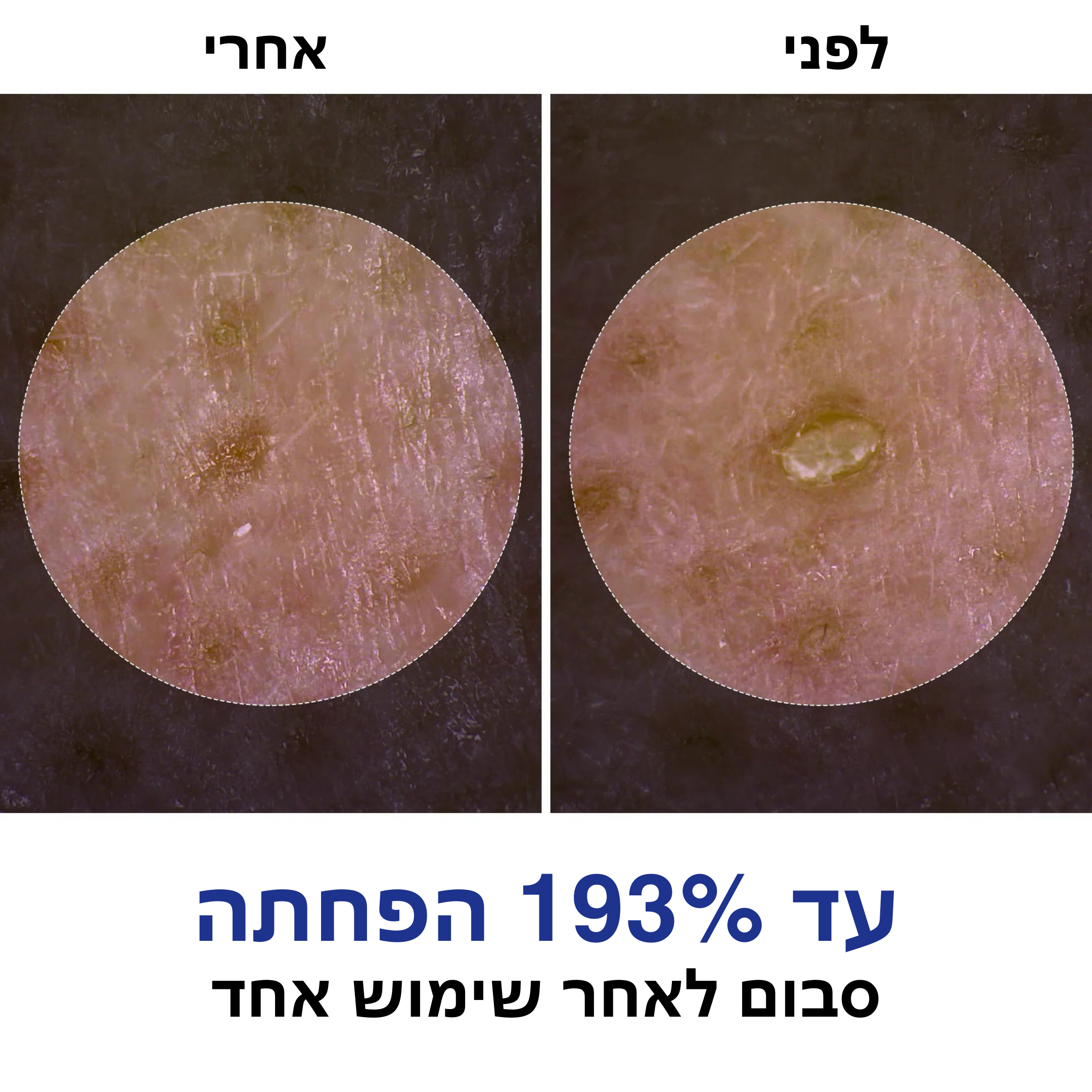 פילשוט™ – פילינג עדין להזנה והבהרת העור