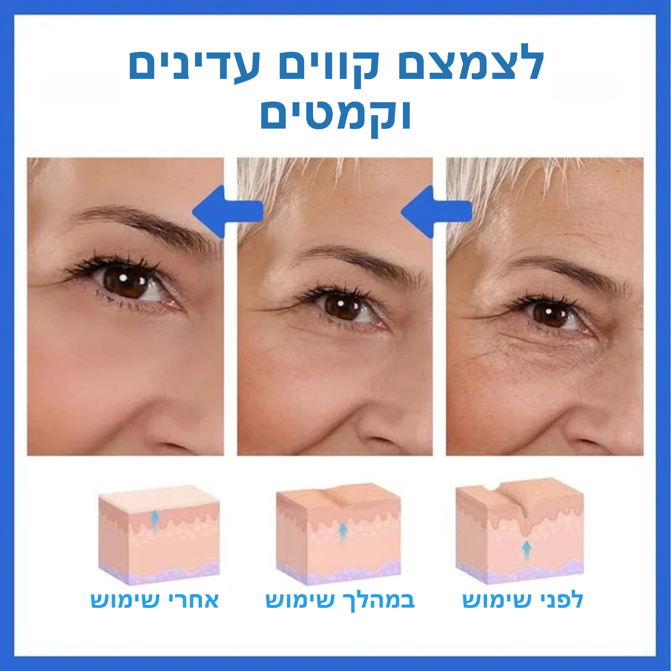 דרמטוקס™ – סרום בוטוקס טבעי למראה צעיר ומתוח