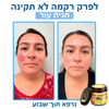 LOVILDS™ – קרם ארס דבורים לטיפול טבעי בבעיות עור