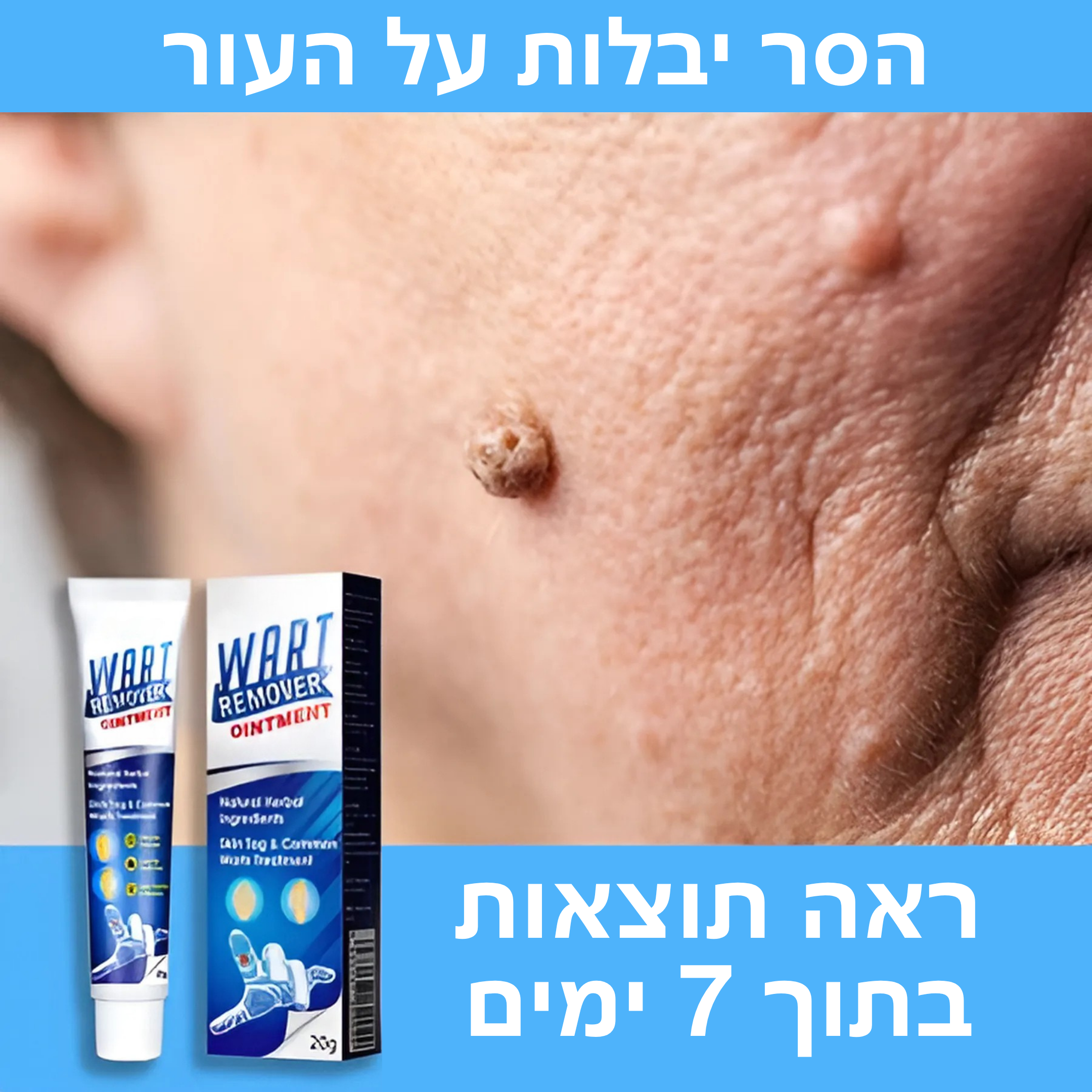 וורטקליר™ – קרם טבעי ובטוח להסרת יבלות ללא צלקות