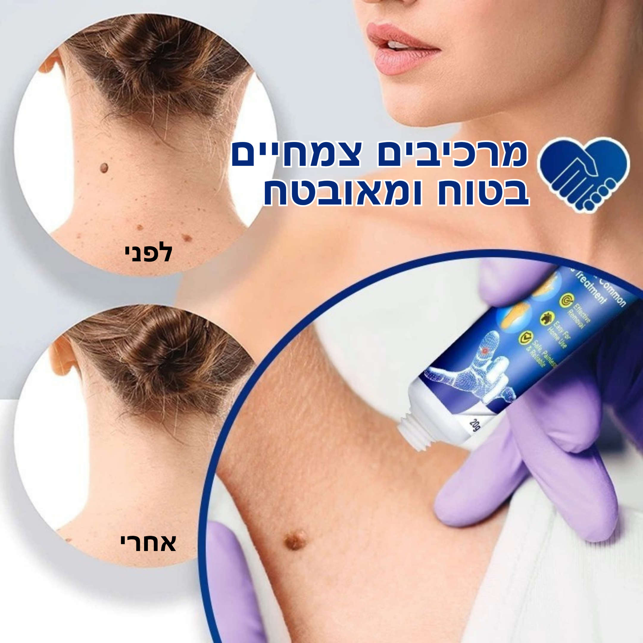 וורטקליר™ – קרם טבעי ובטוח להסרת יבלות ללא צלקות