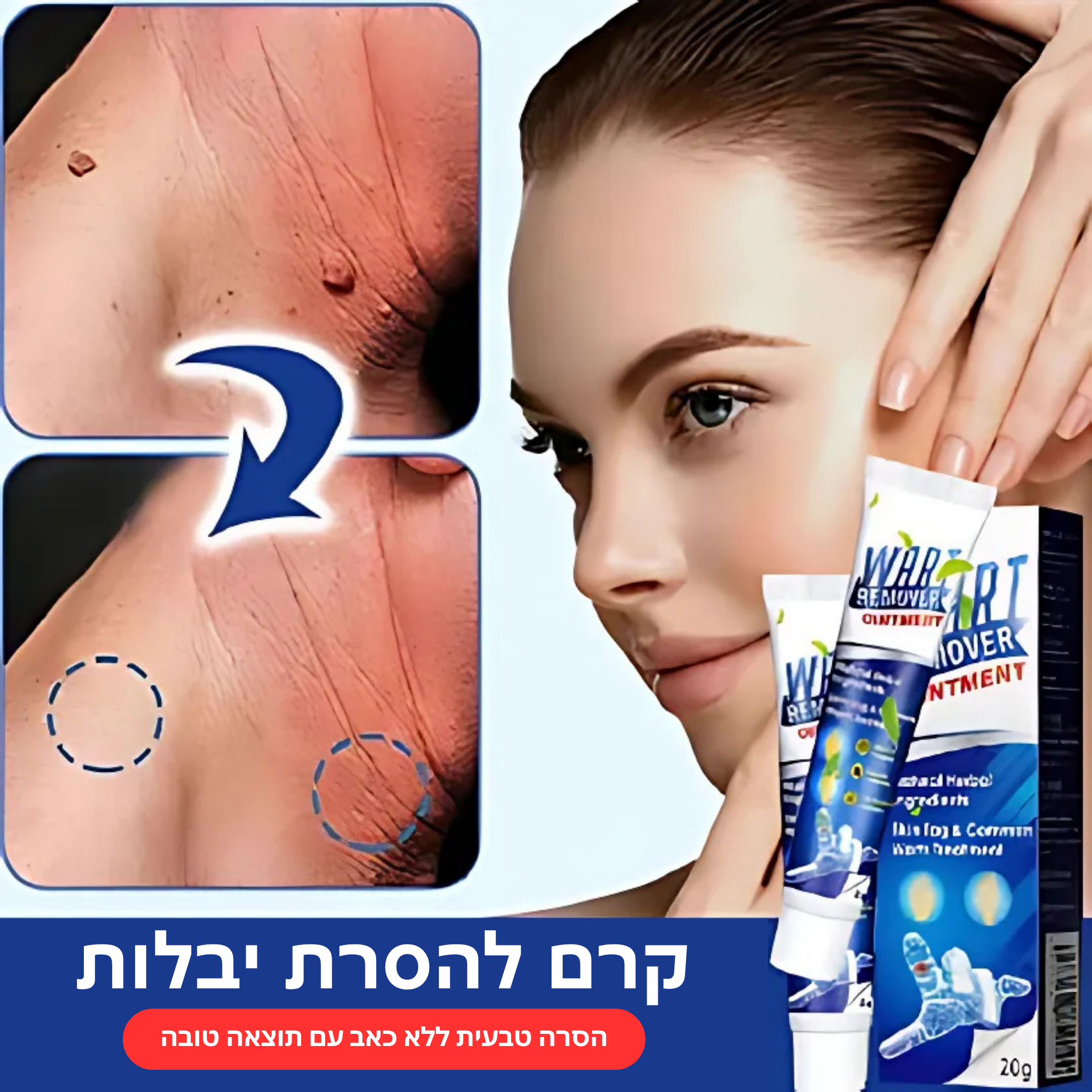 וורטקליר™ – קרם טבעי ובטוח להסרת יבלות ללא צלקות